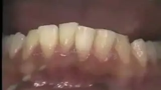 Introduction to Oral Health: Clinic Session I