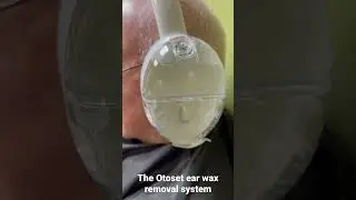 Otoset ear wax removal system