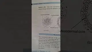 chorionic villi 3 types #malayalam #medico #obstetrics #mbbs