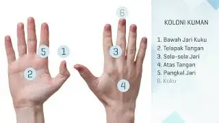 Edukasi pergantian transfer set pasien CAPD