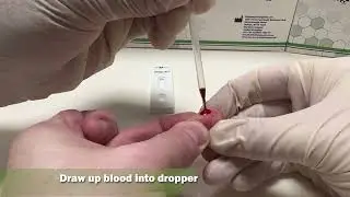 Dengue NS1 Rapid Test