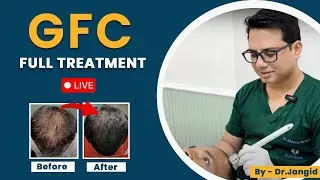 GFC Treatment LIVE | How to get rid of Hair Fall Fast?