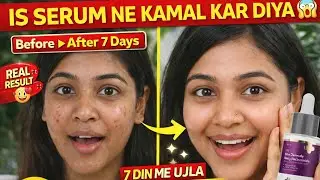 2026 Best tips for Bride the Derma Co 5% Niacinamide Serum Review Before After Result 😍 hindi 