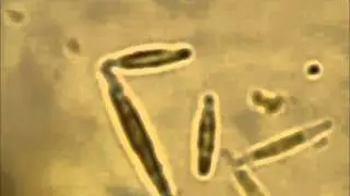 Acartia longiremis III
