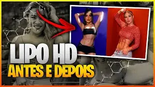 LIPO HD ANTES E DEPOIS [ PASSO A PASSO ]