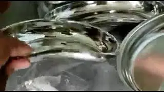 Kidney trays