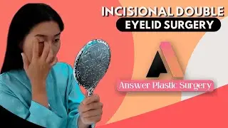 Incisional Double Eyelid Surgery | What to Expect & How It Works | Answer Plastic Surgery