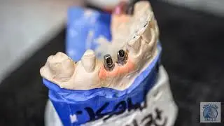Absolute Smile April