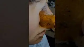 How to remove blackheads naturally #shorts #blackheads #youtube #ytshorts