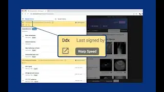 Orbit Discovery Radiology Tutorial - Warp Speed&trade; button and Signing History