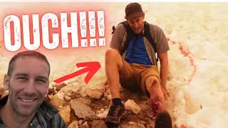 Compound Fracture in the Backcountry | Disastrous Hike in Kings Canyon National Park