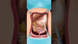 Surgery Simulator Doctor Games android gameplay