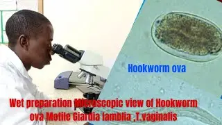WET PREPARATION OF | T. Vaginalis | strongyloides stercoralis trophozoites, Hookworm ova