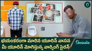 Warning - Bad Smell in Urine | Don&rsquo;t Ignore These Signs | Health Tips | Oneindia Telugu