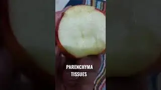 parenchyma tissue shorts