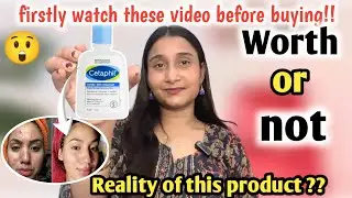 Cetaphil Gentle Skin Cleanser Remove Dark Spots Honest Result | Cetaphil Cleanser Review #cetaphil