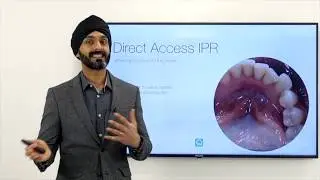 Clear Aligners IPR and Attachments