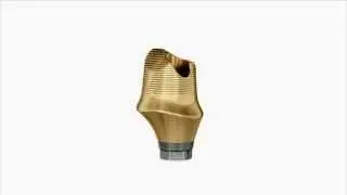 ATLANTIS Abutment &ndash; the freedom of unlimited possibilities for cement-retained restorations