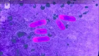 Are bacteria evolving? JSP