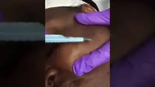 Face2Face Spa Studio Dermaplaning Treatment
