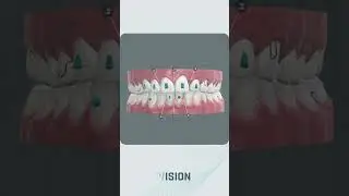 Printed Treatment Plans | Digital Dental Solution