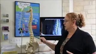 Chiropractor Austin TX | The Cox Flexion-Distraction Technique