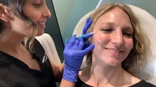 Botox for Women | Movement Lines Treatment | West Hollywood, CA | Dr. Jason Emer