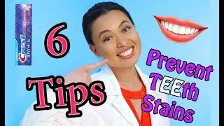 6 Tips to Prevent Teeth Staining | Dentist Recommendation