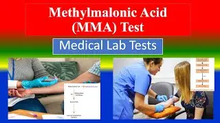 Methylmalonic Acid (MMA) Test - Medical  Lab Tests -  What is ? ,Uses ,Need ,Preparation , Result