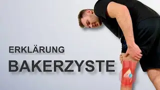 Schmerzen in der Kniekehle (Bakerzyste) loswerden