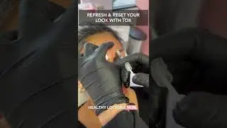 Refresh & Reset With Tox #botox #skintips #cosmeticinjectables #facialaesthetics