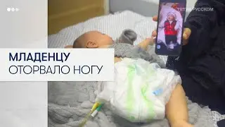 Младенцу оторвало ногу