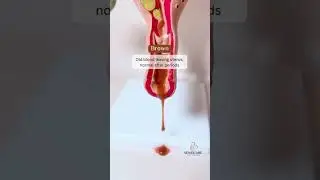 Vaginal discharge is your body&rsquo;s natural way of cleaning and protecting the vagina.
