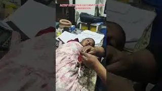 #dynamiccockup radial nerve palsy physio with dynamic cock up splint#shorts