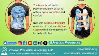 How the Boston Brace Helps Treat Scoliosis? || Precizon Prosthetics & Orthotics