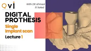 Lecture 1: single implant scan ديجيتال سكان لزرعة واحدة