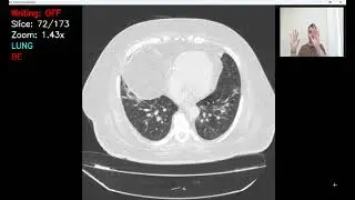 Python Gesture Annotation Tool for DICOM