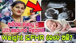 ଆସିଗଲା Baby ର Second Ultrasound Report📄Weight & FHR କେତେ ଅଛି?//Misty Swati Sai Vlog Video 🙏❤️🙏