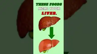 7 Best Foods to Cleanse Your Liver Naturally (Science-Backed). #liverhealth #turmeric #foods
