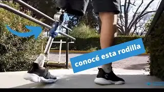 Episodio 70 Protesis arriba de rodilla 3R80 ( Jose Maria )