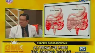 Alternative Cure for Crohn's Disease