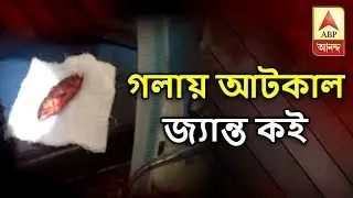 Koi Fish Got Stuck In Tamluk Man's Throat | যুবকের গলায় আটকে গেল জ্যান্ত কইমাছ | ABP Ananda