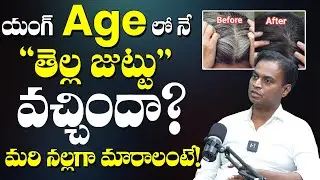 Causes of White Hair at Younger Age | How to Turn White Hair to Black Hair | Dr. Bharadwaz