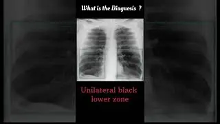 chest x-ray Quiz 11 #@radiologychannel007