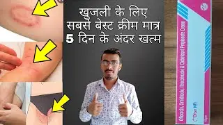 मात्र 5 दिन मे दाद खाज खुजली जड़ से खत्म।। dad khaj khujali ki cream