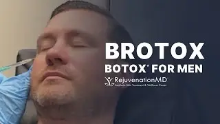 Botox for Men: Treat Crow&rsquo;s Feet, Glabella, and Forehead