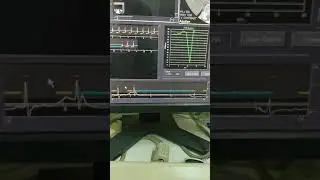 ! ECG edit in Toshiba  Arabic ,,not english