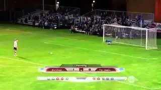 Scott Sterling and His Face of Steel