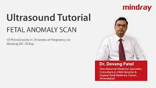 Fetal Anomaly scan by Dr Devang Patel on Mindray DC-70 Expert Ultrasound System