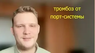 Выбор между АБВД и Беакопп-14